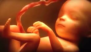 Fetus